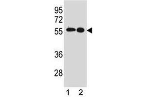 Src antibody western blot analysis in (1) MCF-7 and (2) A431 lysate