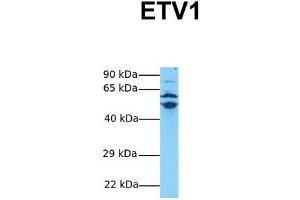 Host:  Rabbit  Target Name:  ETV1  Sample Tissue:  Human MDA-MB-435s  Antibody Dilution:  1.