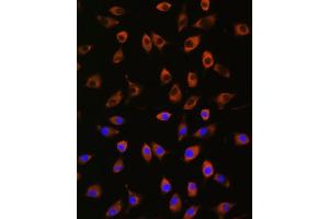 Immunofluorescence analysis of L929 cells using PPP1R9B antibody (ABIN7269681) at dilution of 1:100.