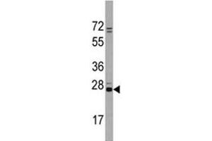Western blot analysis of CD9 antibody and Jurkat lysate.