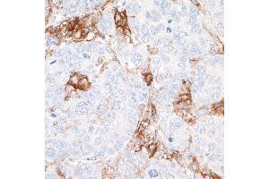 Immunohistochemistry (IHC) image for anti-CD40 (CD40) (AA 227-277) antibody (ABIN7454023) (Recombinant CD40 anticorps  (AA 227-277))