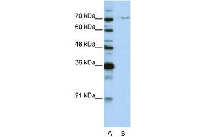WB Suggested Anti-PRPF3 Antibody Titration:  0. (PRPF3 anticorps  (N-Term))