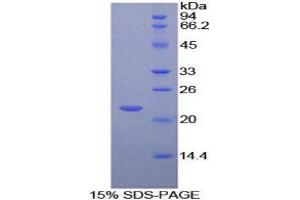 SDS-PAGE (SDS) image for Myeloproliferative Leukemia Virus Oncogene (MPL) (AA 311-460) protein (His tag) (ABIN1879570) (MPL Protein (AA 311-460) (His tag))
