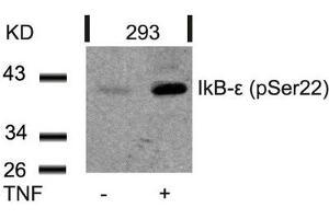 Western blot analysis of extracts from 293 cells untreated or treated with TNF using IkB-e(Phospho-Ser22) Antibody. (NFKBIE anticorps  (pSer22))