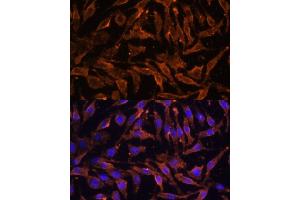 Immunofluorescence analysis of L929 cells using TNFRSF11A Polyclonal Antibody (ABIN6127588, ABIN6149309, ABIN6149311 and ABIN6216817) at dilution of 1:100 (40x lens). (TNFRSF11A anticorps  (AA 466-616))