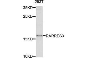 Western blot analysis of extracts of 293T cells, using RARRES3 antibody (ABIN5995728) at 1/1000 dilution.