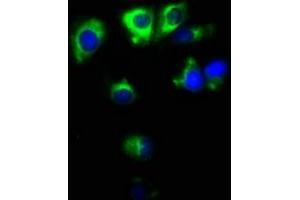 Immunofluorescence staining of MCF-7 cells with ABIN7171138 at 1:100, counter-stained with DAPI. (Synaptoporin anticorps  (AA 199-265))