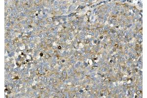 IHC analysis of ASAH1 using anti-ASAH1 antibody (ABIN7602206). (ASAH1 anticorps  (AA 63-393))