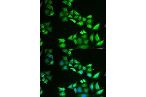 Immunofluorescence analysis of U2OS cells using CCBL1 antibody. (CCBL1 anticorps  (AA 1-270))