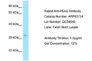 Western Blotting (WB) image for anti-Plasminogen Activator, Urokinase (PLAU) (C-Term) antibody (ABIN2789605) (PLAU anticorps  (C-Term))