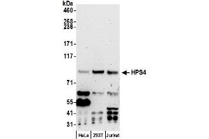 anti-Hermansky-Pudlak Syndrome 4 (HPS4) (AA 658-708) antibody