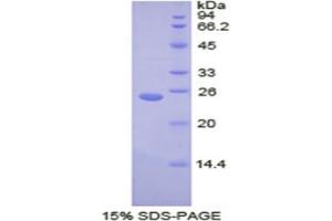 SDS-PAGE analysis of Human Transportin 1 Protein. (Transportin 1 Protein (TNPO1))