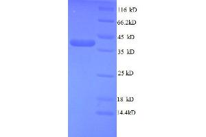 SDS-PAGE (SDS) image for Teratocarcinoma-Derived Growth Factor 1 (TDGF1) (AA 32-150), (partial) protein (GST tag) (ABIN1047738) (TDGF1 Protein (AA 32-150, partial) (GST tag))