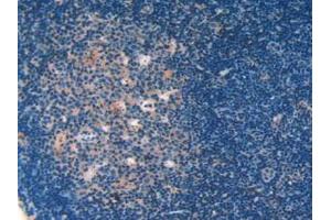 IHC-P analysis of Mouse Lymph Node Tissue, with DAB staining. (Galectin 9 anticorps  (AA 225-353))