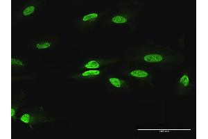 Immunofluorescence of purified MaxPab antibody to PAX2 on HeLa cell. (PAX2A anticorps  (AA 1-431))