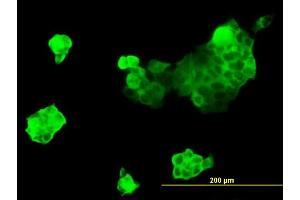 Immunofluorescence of monoclonal antibody to MYH9 on A-431 cell. (Myosin 9 anticorps  (AA 131-220))