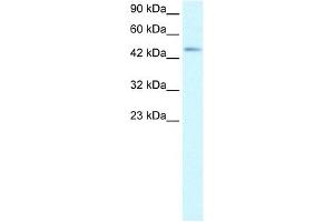 CCR8 antibody (20R-1321) used at 5 ug/ml to detect target protein. (CCR8 anticorps  (Middle Region))