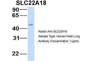 Host:  Rabbit  Target Name:  SLC22A18  Sample Type:  Human Fetal Lung  Antibody Dilution:  1. (ORCTL-2/SLC22A18 anticorps  (N-Term))