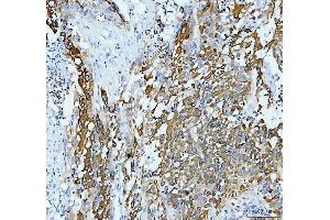 IHC analysis of AGR2 using anti-AGR2 antibody (ABIN5518726). (AGR2 anticorps  (AA 21-175))