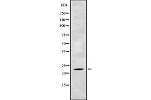 Western blot analysis of TAF10 using Jurkat whole cell lysates