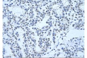 Rabbit Anti-HNRNPH3 Antibody       Paraffin Embedded Tissue:  Human alveolar cell   Cellular Data:  Epithelial cells of renal tubule  Antibody Concentration:   4.