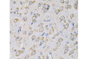 Immunohistochemistry of paraffin-embedded Rat brain using IL10RA Polyclonal Antibody at dilution of 1:100 (40x lens). (IL-10RA anticorps)