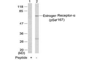 Image no. 3 for anti-Estrogen Receptor 1 (ESR1) (pSer167) antibody (ABIN196745) (Estrogen Receptor alpha anticorps  (pSer167))
