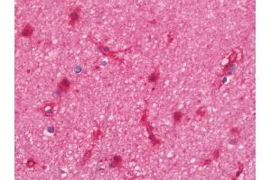 Anti-SNTA1 / Syntrophin Alpha 1 antibody IHC staining of human brain, cortex.