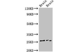 Western Blot Positive WB detected in: Rat brain tissue, Mouse brain tissue All lanes: FAM3B antibody at 3 μg/mL Secondary Goat polyclonal to rabbit IgG at 1/50000 dilution Predicted band size: 26, 31, 21 kDa Observed band size: 26 kDa (FAM3B anticorps  (AA 31-235))