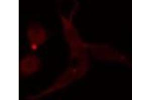 ABIN6276825 staining  A549 cells by IF/ICC.