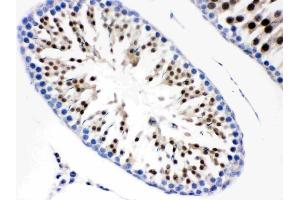 IHC analysis of Cdc6 using anti-Cdc6 antibody (ABIN3043500). (CDC6 anticorps  (AA 147-549))
