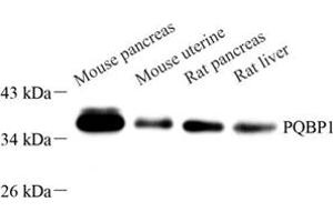 Western blot analysis of PQBP1 (ABIN7075126) at dilution of 1: 1000 (PQBP1 anticorps)