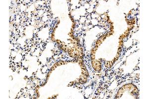 anti-Transducin (Beta)-Like 1X-Linked (TBL1X) (Internal Region) antibody