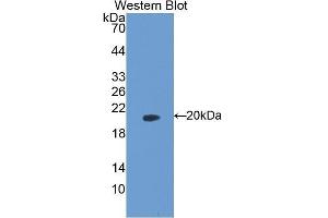 Western Blotting (WB) image for anti-Peptidylprolyl Cis/trans Isomerase, NIMA-Interacting 1 (PIN1) (AA 2-165) antibody (ABIN1078430) (PIN1 anticorps  (AA 2-165))