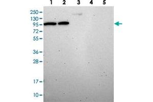 Western blot analysis of DDX27 polyclonal antibody .