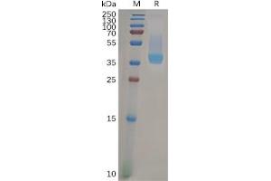 Human CXCR4 Protein, hFc Tag on SDS-PAGE under reducing condition. (CXCR4 Protein (Fc Tag))