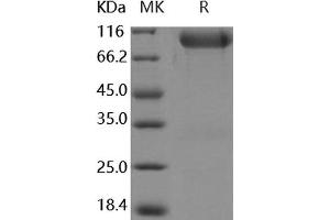 Western Blotting (WB) image for Fibroblast Growth Factor Receptor 3 (FGFR3) protein (Fc Tag) (ABIN7195777)