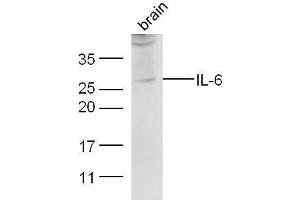 Mouse brain lysate probed with Anti-IL-6 Polyclonal Antibody  at 1:5000 90min in 37˚C.