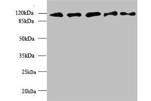 Western blot All lanes: MORC2 antibody at 6 μg/mL Lane 1: U87 whole cell lysate Lane 2: U251 whole cell lysate Lane 3: Jurkat whole cell lysate Lane 4: Hela whole cell lysate Lane 5: MCF-7 whole cell lysate Secondary Goat polyclonal to rabbit IgG at 1/10000 dilution Predicted band size: 118, 111 kDa Observed band size: 118 kDa