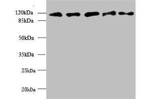 Western blot All lanes: MORC2 antibody at 6 μg/mL Lane 1: U87 whole cell lysate Lane 2: U251 whole cell lysate Lane 3: Jurkat whole cell lysate Lane 4: Hela whole cell lysate Lane 5: MCF-7 whole cell lysate Secondary Goat polyclonal to rabbit IgG at 1/10000 dilution Predicted band size: 118, 111 kDa Observed band size: 118 kDa (MORC2 anticorps  (AA 2-300))