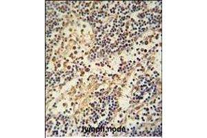 HEMK1 antibody (C-term) (ABIN654963 and ABIN2844602) immunohistochemistry analysis in formalin fixed and paraffin embedded human lymph node followed by peroxidase conjugation of the secondary antibody and DAB staining. (HEMK1 anticorps  (C-Term))
