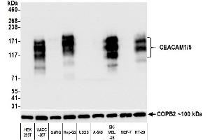 Western Blotting (WB) image for anti-Carcinoembryonic Antigen-Related Cell Adhesion Molecule 1/5 (CEACAM1/5) (AA 35-433) antibody (ABIN7455139) (Recombinant CEACAM1/5 anticorps  (AA 35-433))