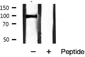 Western blot analysis of Catenin α1 expression in mouse muscle tissue lysates,The lane on the right is treated with the antigen-specific peptide.