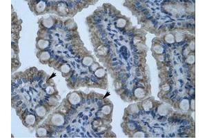 Image no. 1 for anti-Zinc Finger Protein 461 (ZNF461) (AA 26-75) antibody (ABIN203139)