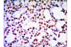 Immunohistochemical analysis of paraffin-embedded human kidney tissue using PP32 mouse mAb with DAB staining.