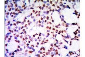 Immunohistochemical analysis of paraffin-embedded human kidney tissue using PP32 mouse mAb with DAB staining. (PHAP1 anticorps)