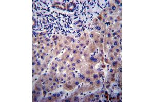 Immunohistochemistry (IHC) image for anti-Cytochrome P450, Family 3, Subfamily A, Polypeptide 4 (CYP3A4) antibody (ABIN2897882)