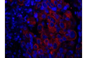 Immunofluorescence (IF) image for anti-SAM and SH3 Domain Containing 1 (SASH1) (AA 750-800) antibody (ABIN7449021) (SASH1 anticorps  (AA 750-800))