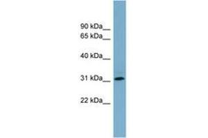 Image no. 1 for anti-Ring Finger Protein 144B (RNF144B) (AA 215-264) antibody (ABIN6743180) (RNF144B anticorps  (AA 215-264))