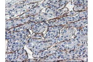 Image no. 1 for anti-Low Density Lipoprotein Receptor Adaptor Protein 1 (LDLRAP1) antibody (ABIN1496691) (LDLRAP1 anticorps)